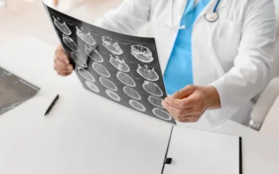 Long-Term Costs and Compensation for Traumatic Brain Injuries